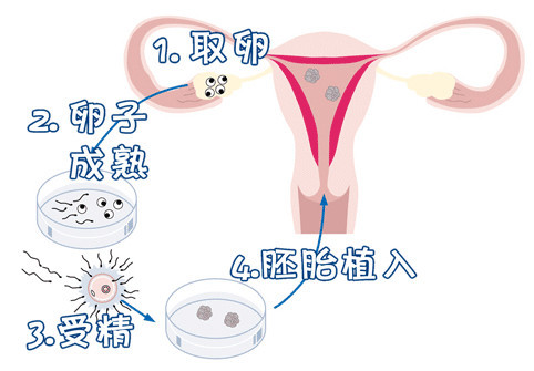 时差成像